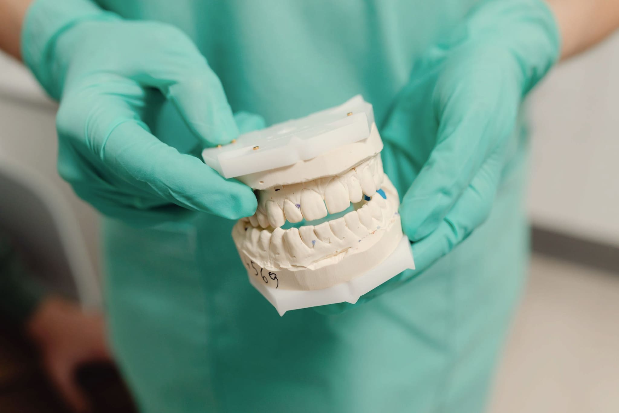 Mãos com luvas segurando um modelo de arcada dentária, com os dentes se encontrando